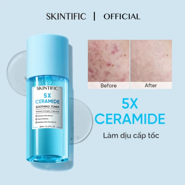 Toner làm da dịu SKINTIFIC